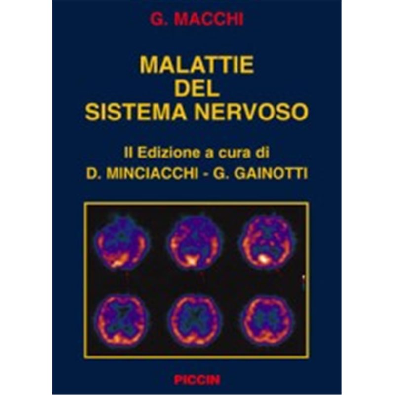 Malattie del Sistema Nervoso